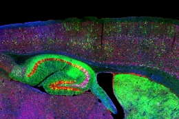 NPC hippocampus. From NICHD via Flickr (https://www.google.it/search?rlz=1C1GGRV_enIT751IT751&biw=1395&bih=606&tbs=sur%3Afc&tbm=isch&sa=1&q=neurodegenerative+diseases&oq=neurodegenera&gs_l=psy-ab.1.0.0l4.3350.8358.0.9931.13.13.0.0.0.0.76.909.13.13.0....0...1.1.64.psy-ab..0.13.908....0.czh61VovQ9M#imgrc=Sca7L4g-EN5rCM:), cc (https://creativecommons.org/licenses/by/2.0/)